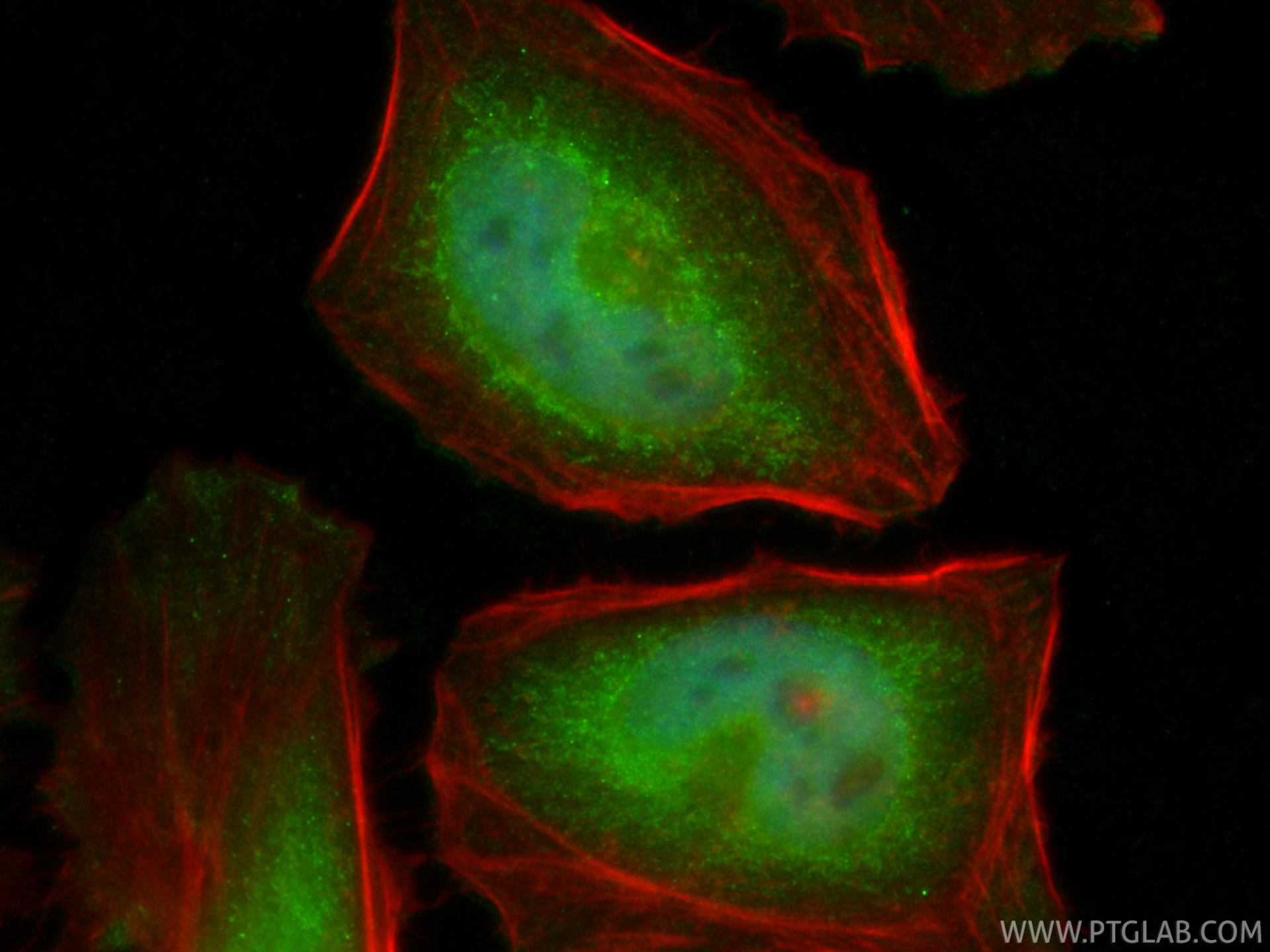 IF Staining of HeLa using CL488-13423 IF Staining of HeLa using CL488-13423