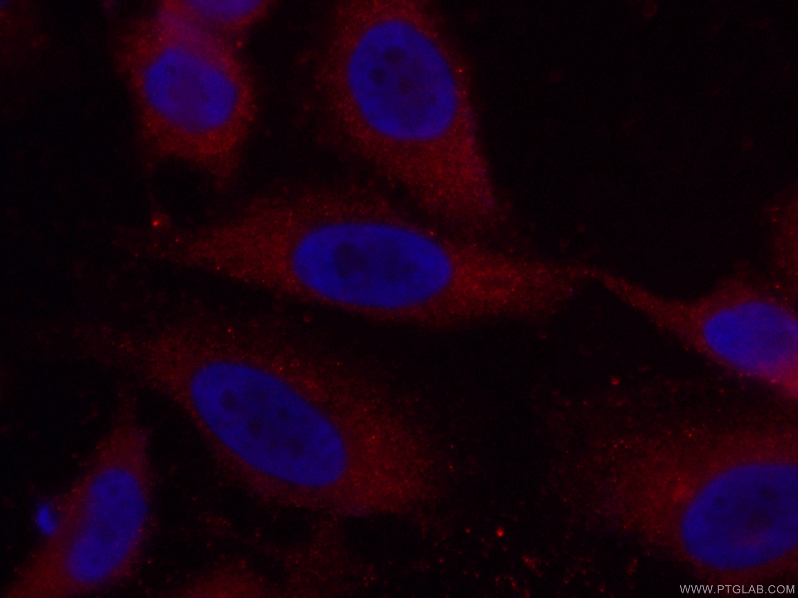 IF Staining of HeLa using CL594-66093