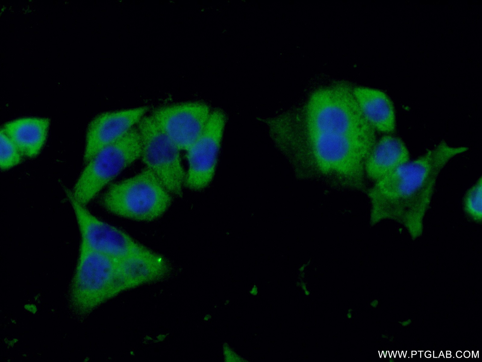 IF Staining of HeLa using 66169-1-Ig