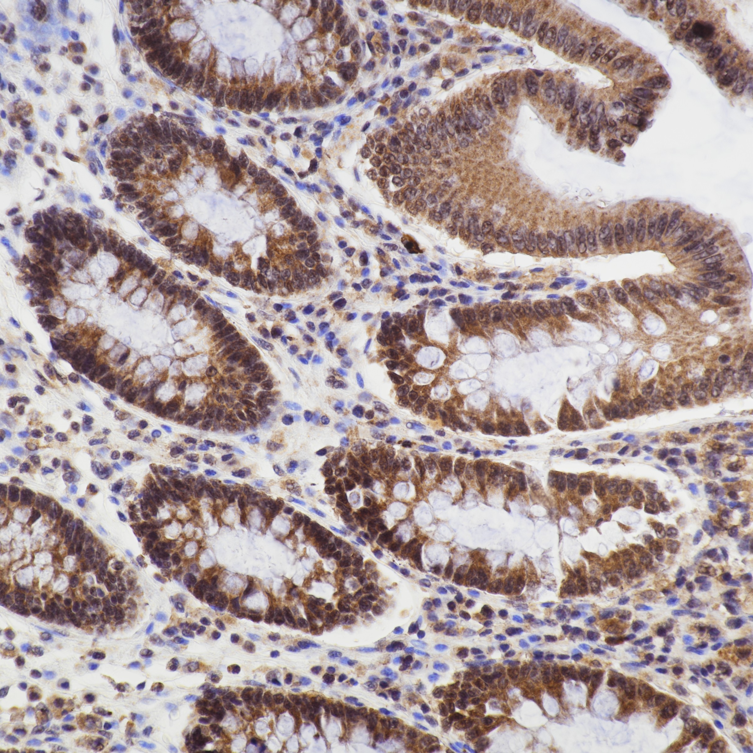 IHC staining of human colon using 66169-1-Ig IHC staining of human colon using 66169-1-Ig