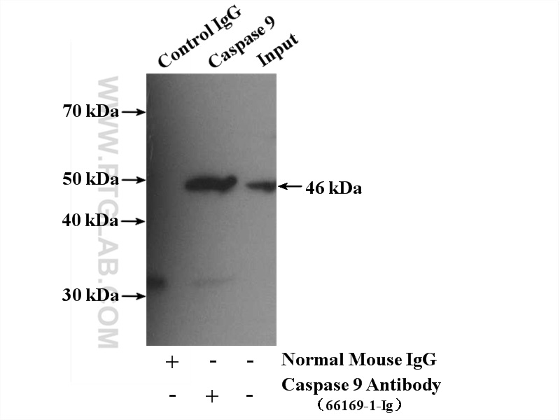IP experiment of HeLa using 66169-1-Ig