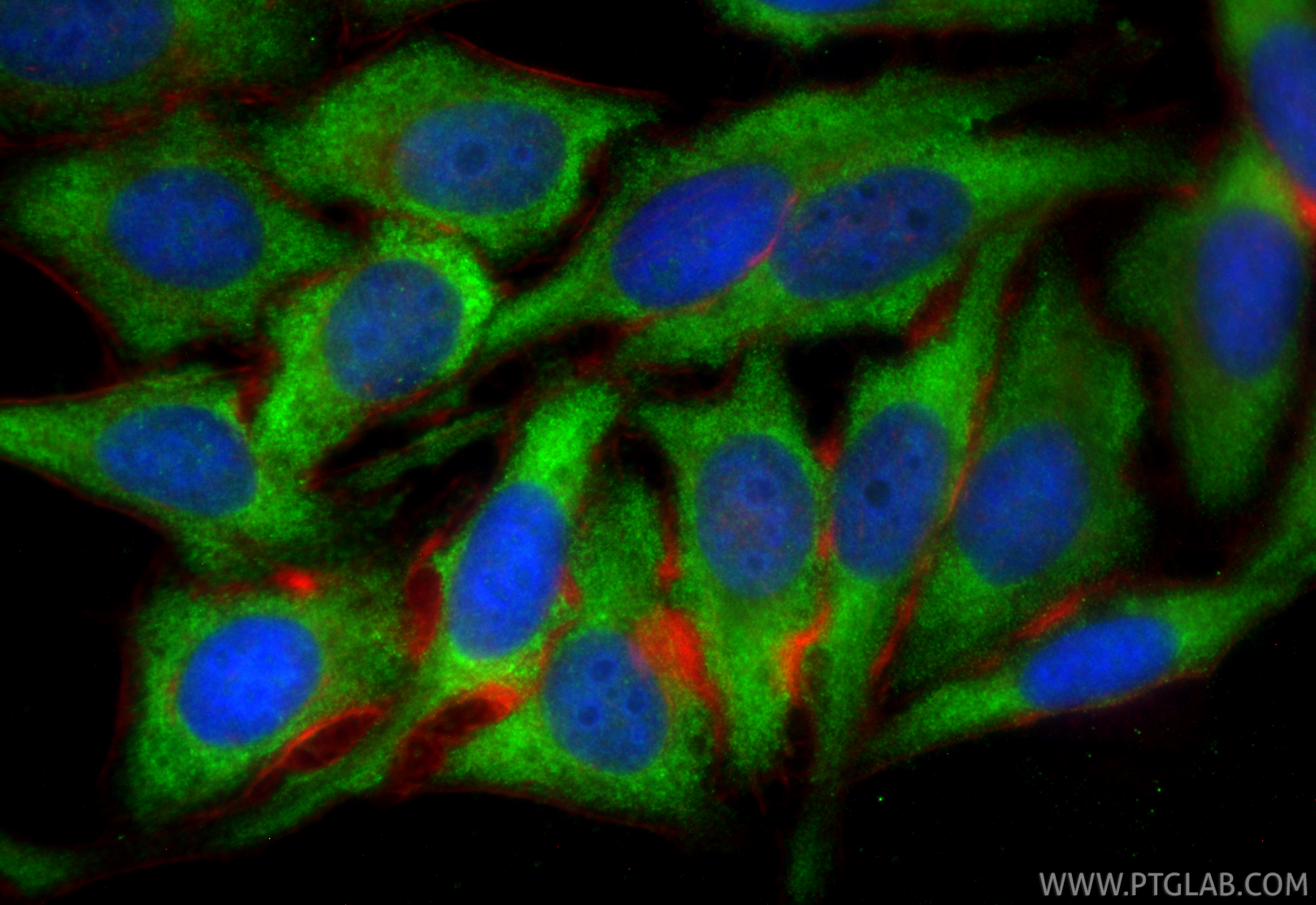 IF Staining of HepG2 using CL488-66169 IF Staining of HepG2 using CL488-66169