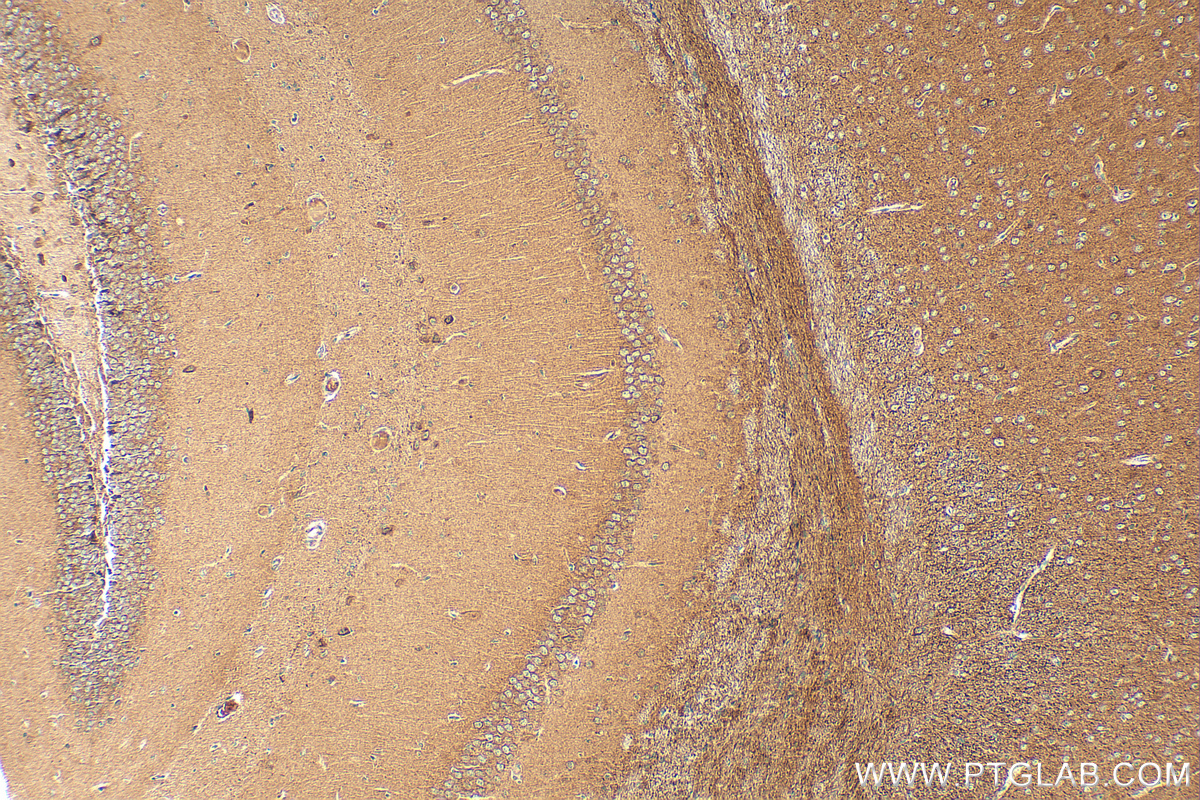 IHC staining of mouse brain using 25838-1-AP