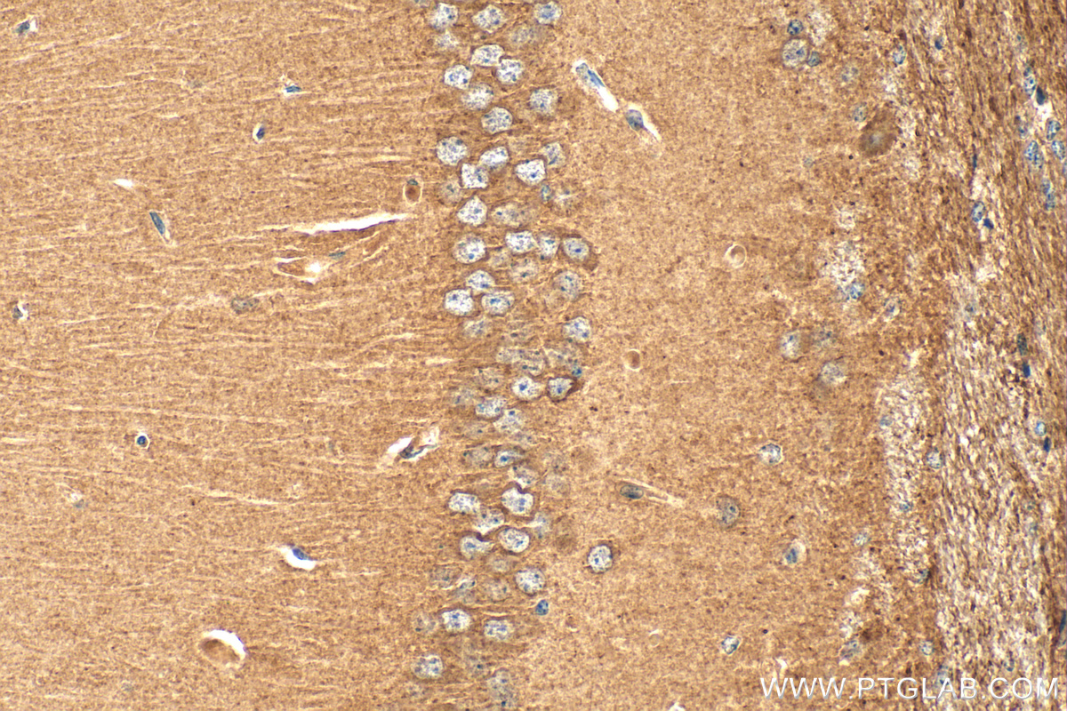 IHC staining of mouse brain using 25838-1-AP