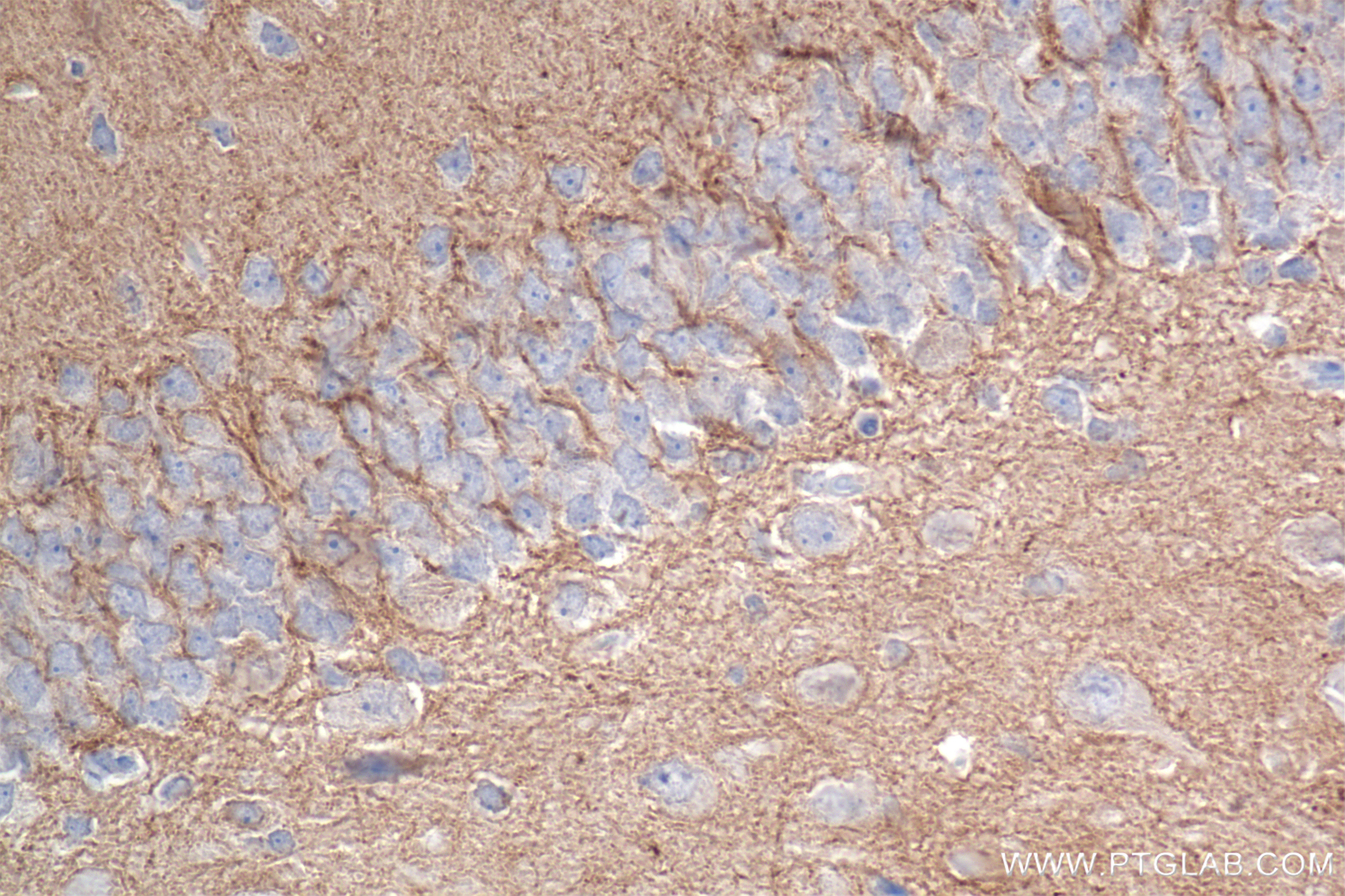 IHC staining of rat brain using 85116-4-RR