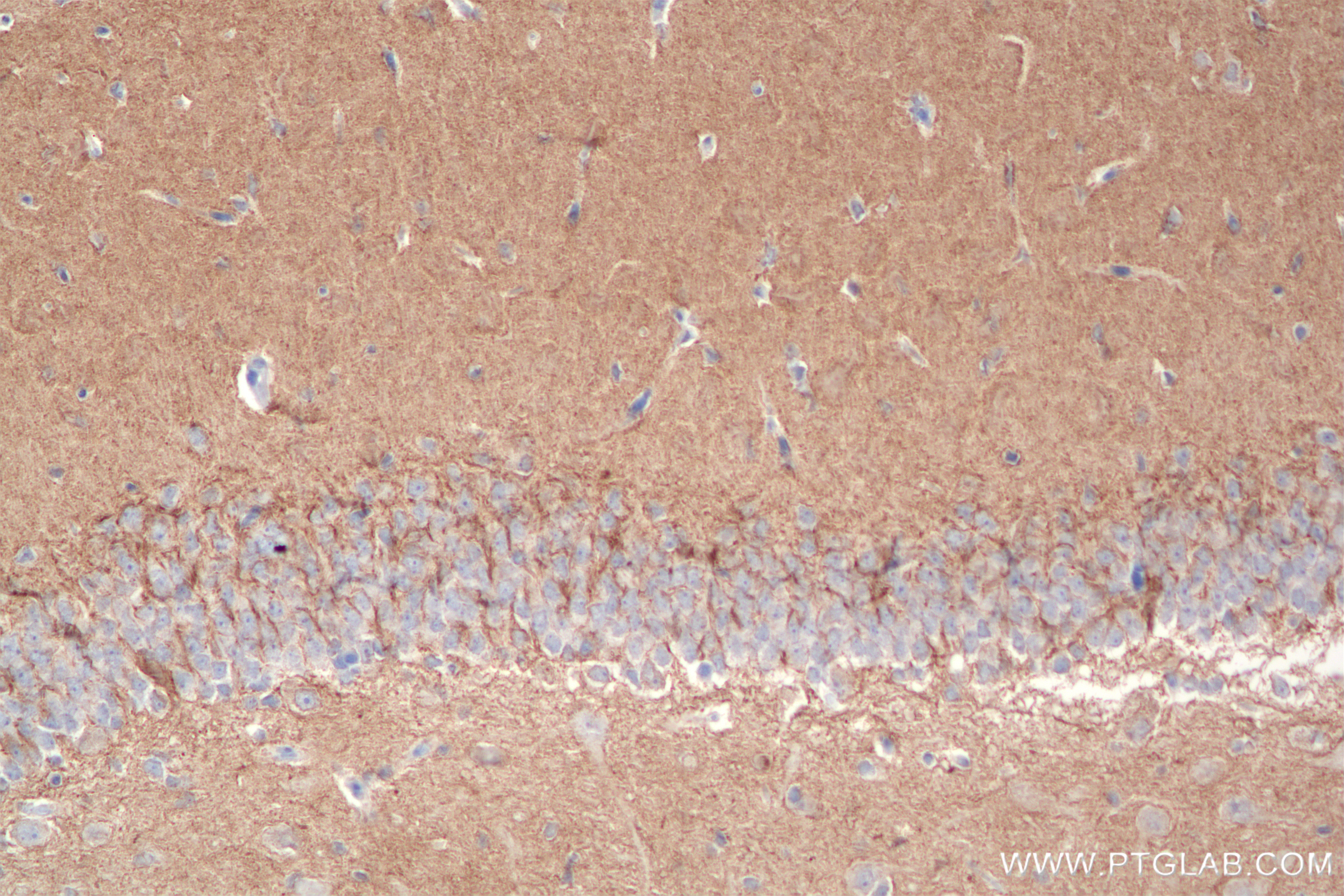 IHC staining of rat brain using 85116-4-RR