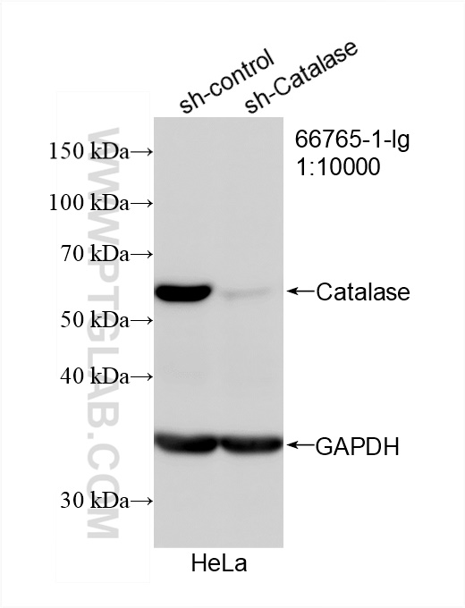 WB analysis of HeLa using 66765-1-Ig (same clone as 66765-1-PBS)