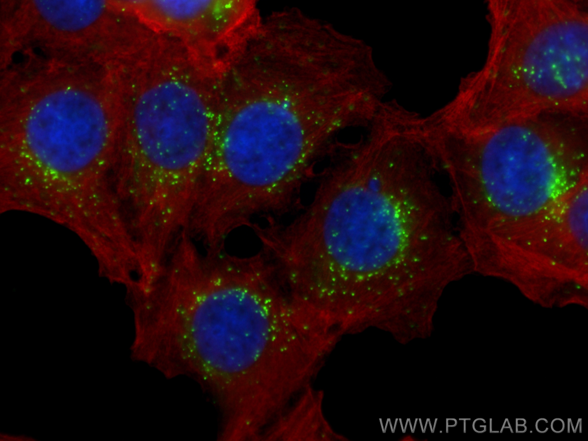 IF Staining of MCF-7 using 83743-2-RR