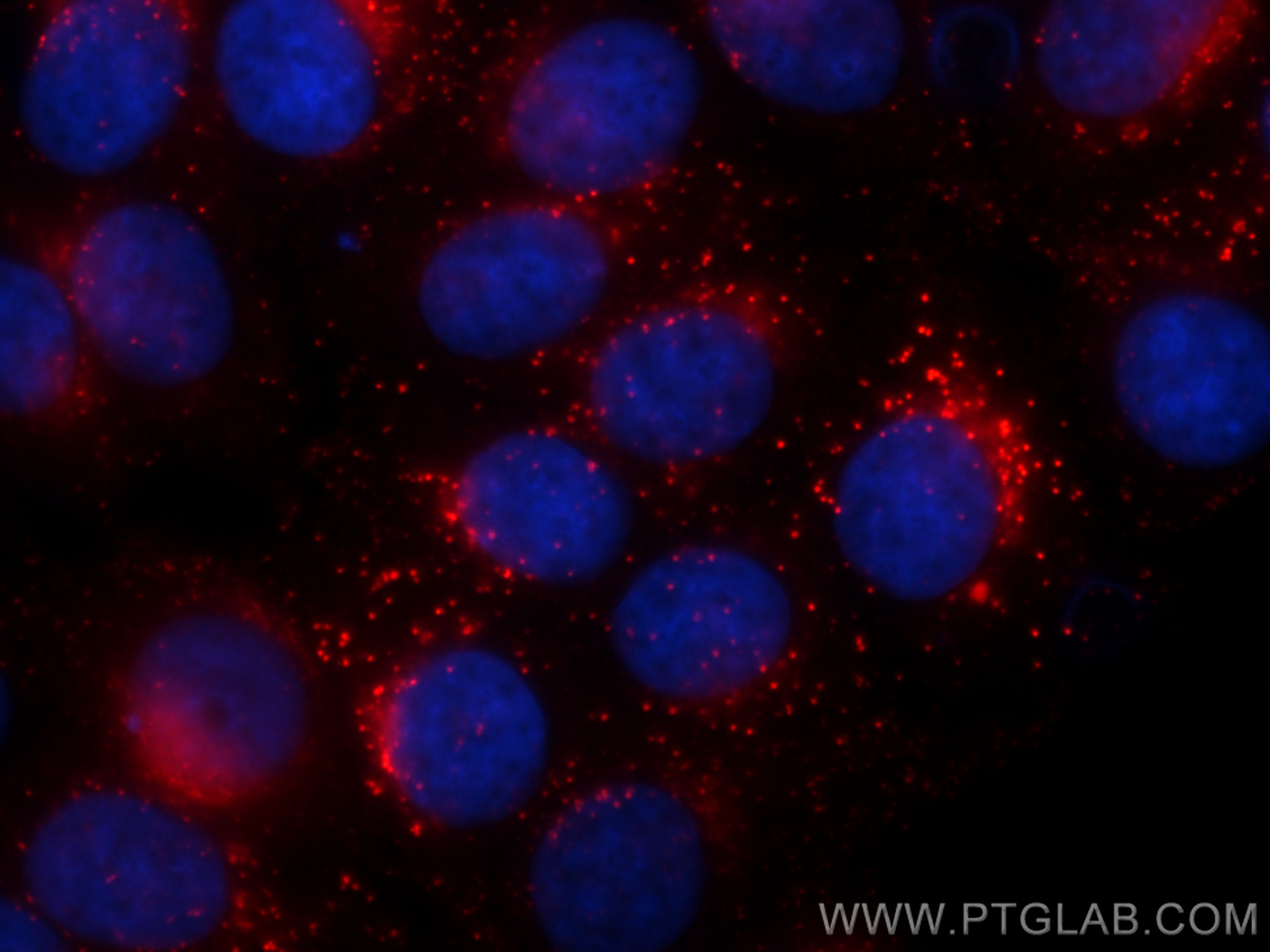 IF Staining of MCF-7 using RMX00012 IF Staining of MCF-7 using RMX00012