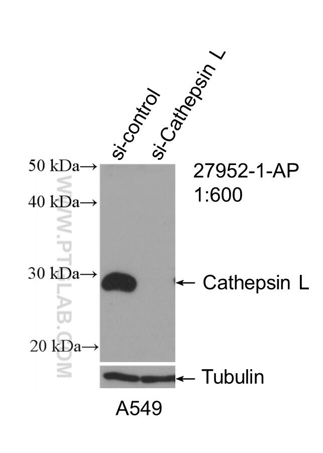 WB analysis of A549 using 27952-1-AP