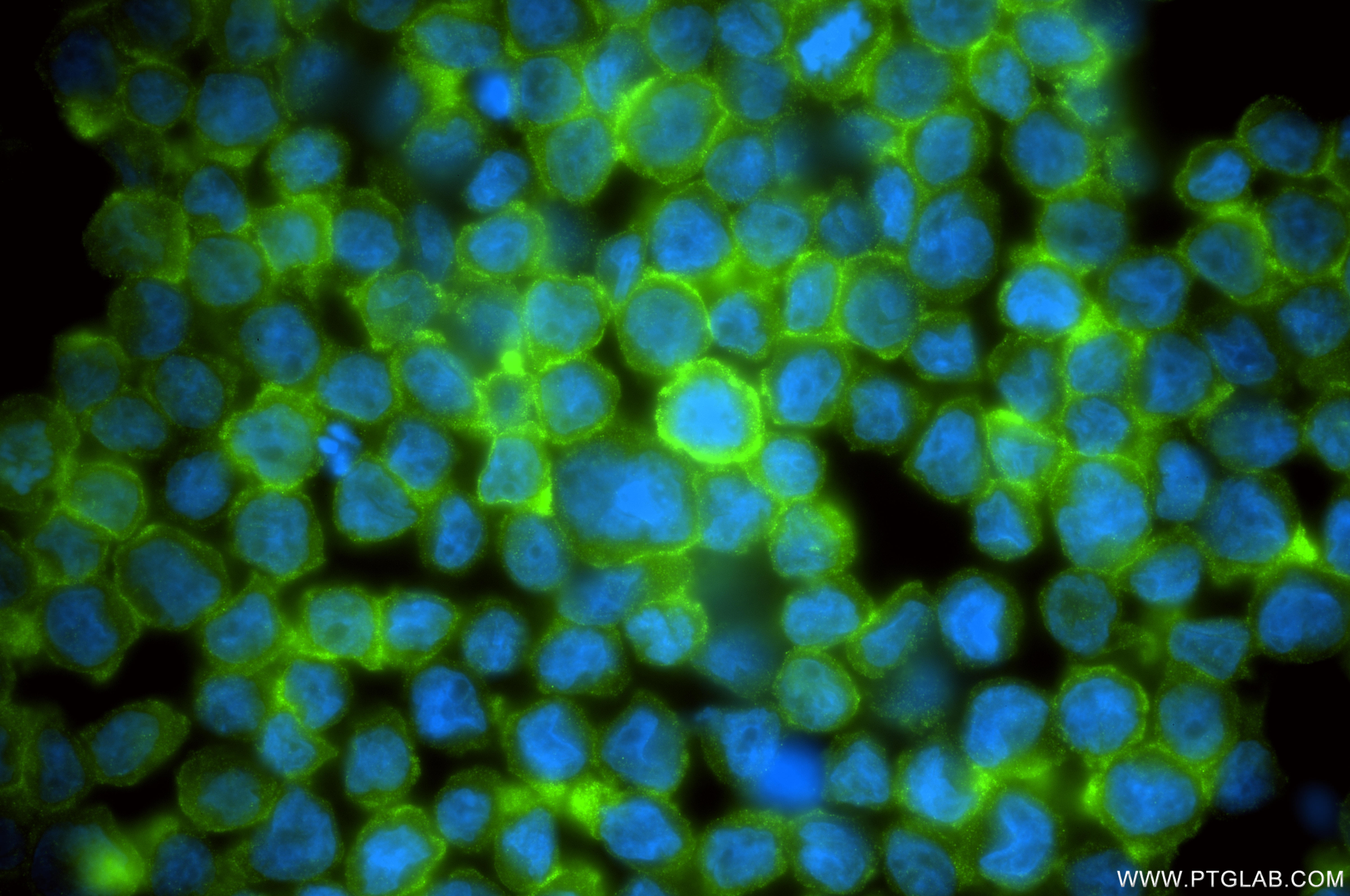 IF Staining of THP-1 using 86948-1-RR (same clone as 86948-1-PBS)