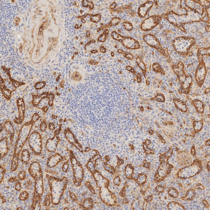 IHC staining of human spleen using 84044-1-RR