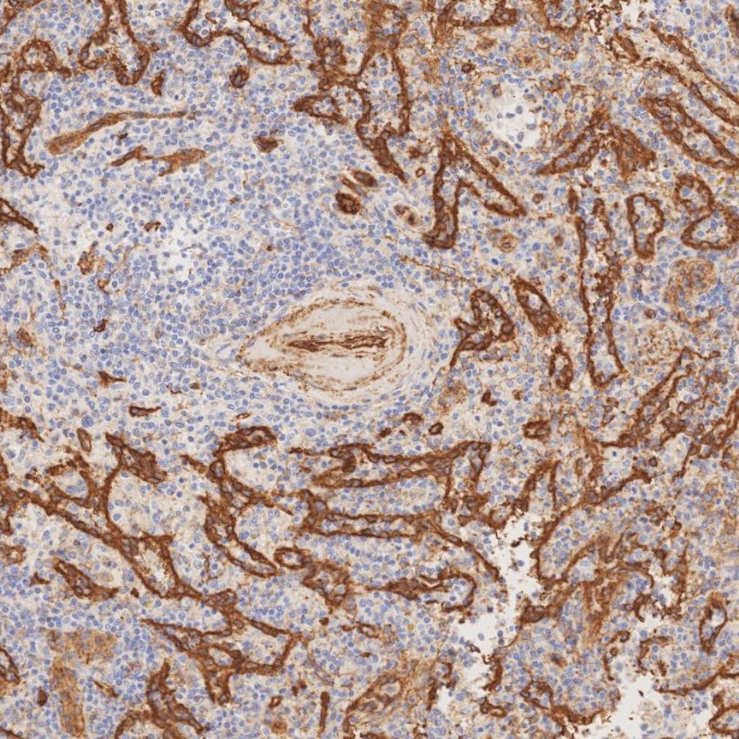 IHC staining of human spleen using 84044-1-RR