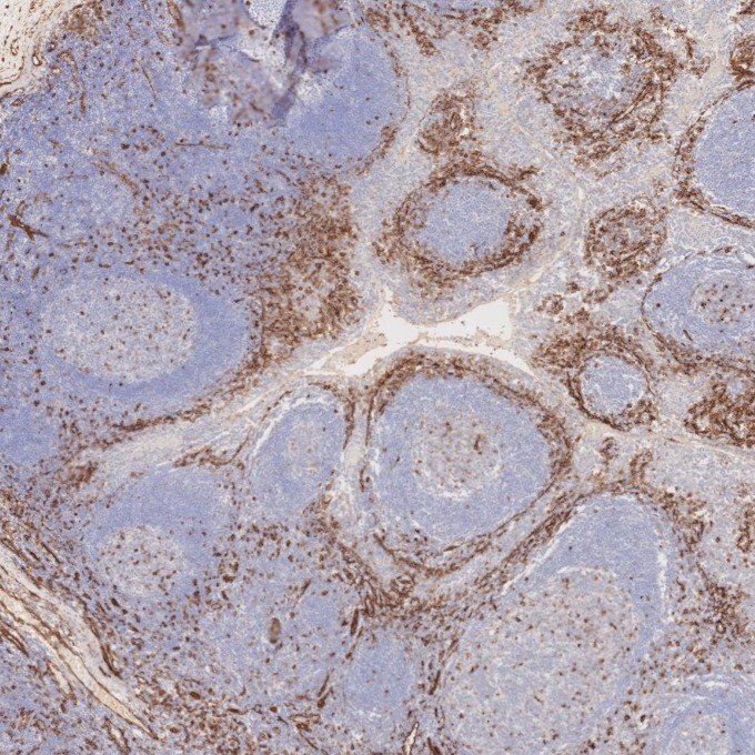 IHC staining of human tonsillitis using 84044-1-RR