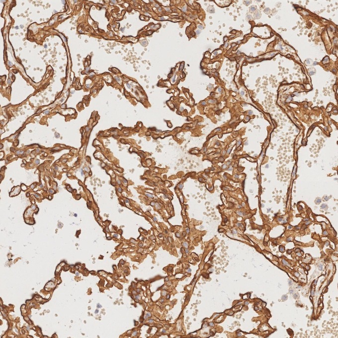 IHC staining of human lung using 84044-1-RR