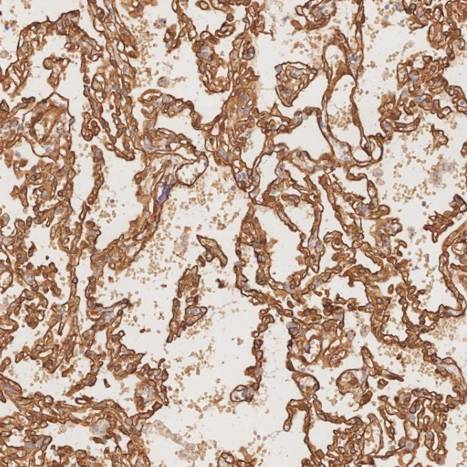 IHC staining of human lung using 84044-1-RR