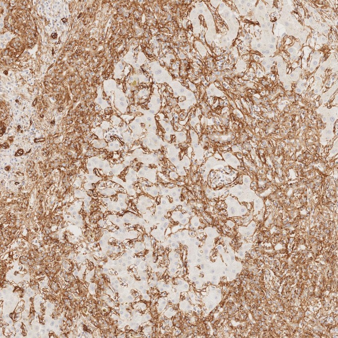 IHC staining of human liver using 84044-1-RR