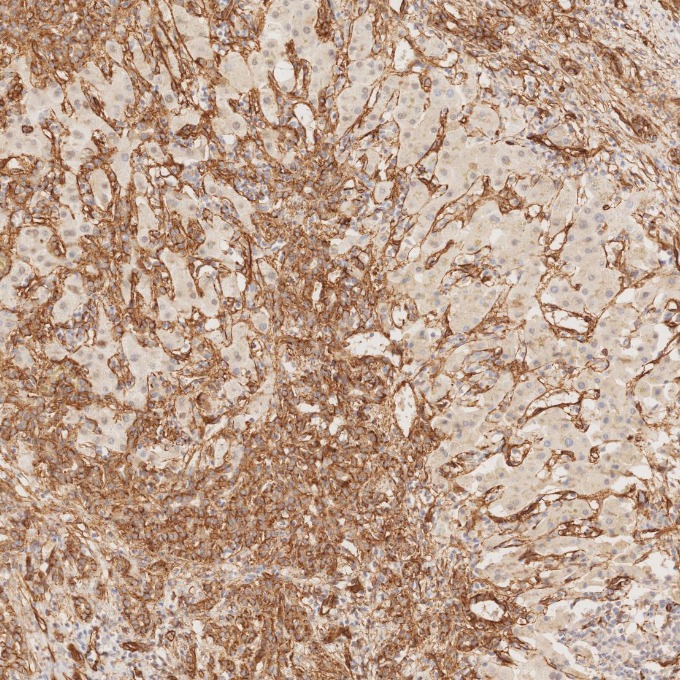 IHC staining of human liver using 84044-1-RR