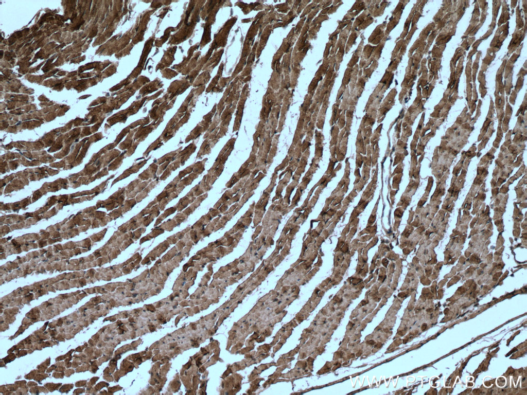 IHC staining of mouse heart using 28358-1-AP