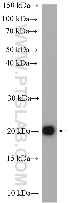 WB analysis of mouse colon using 28358-1-AP