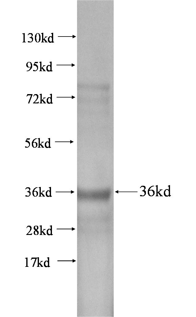 Ccl8 fusion protein Ag0466 SDS-PAGE
