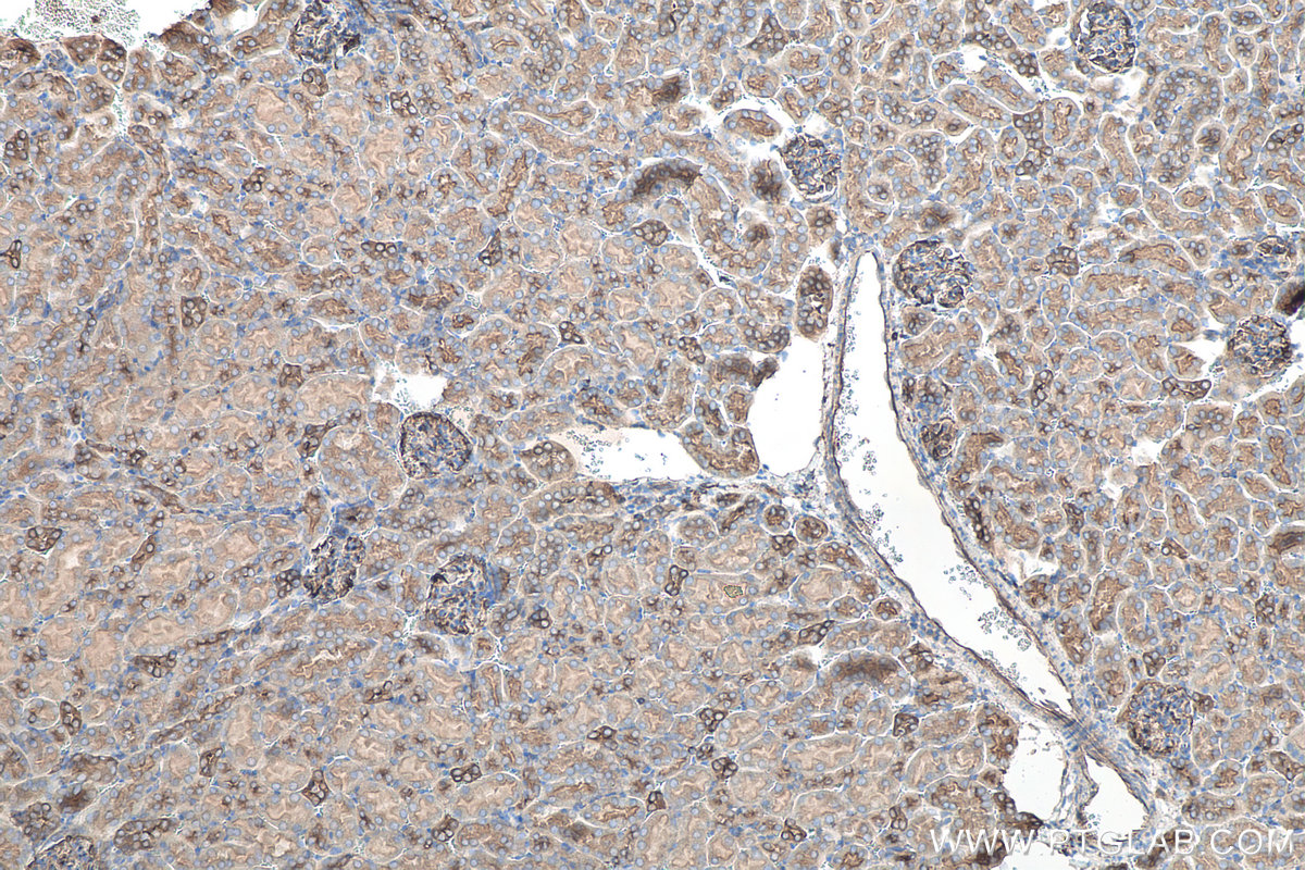 IHC staining of mouse kidney using 24122-1-AP