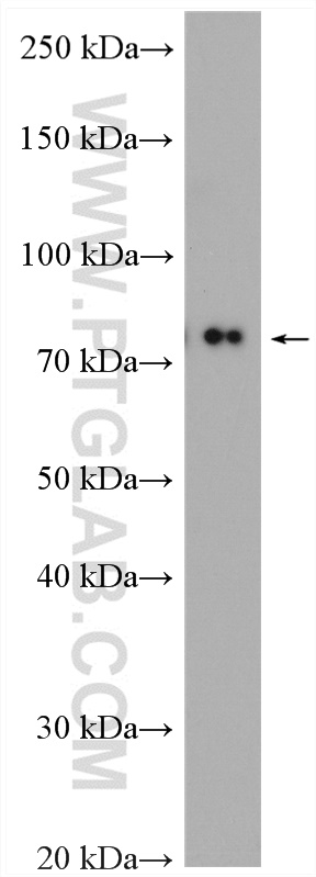 WB analysis of mouse kidney using 24122-1-AP