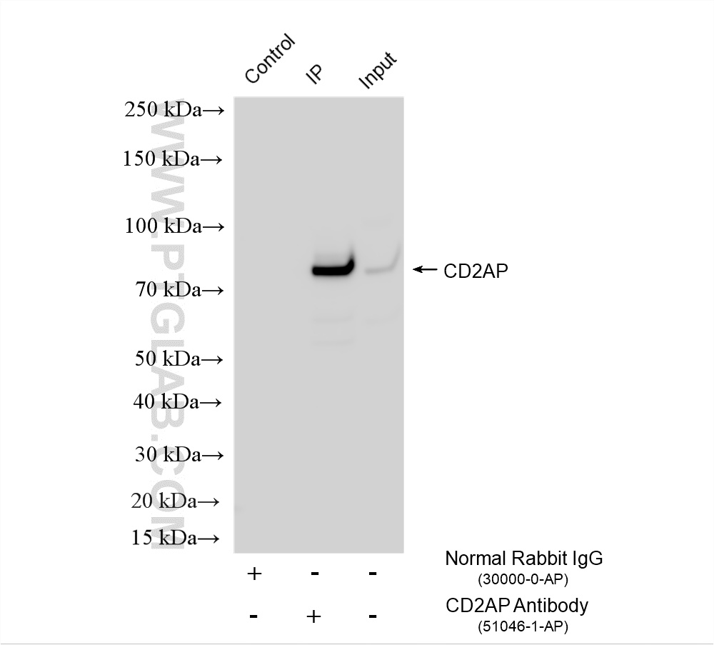 IP experiment of mouse brain using 51046-1-AP