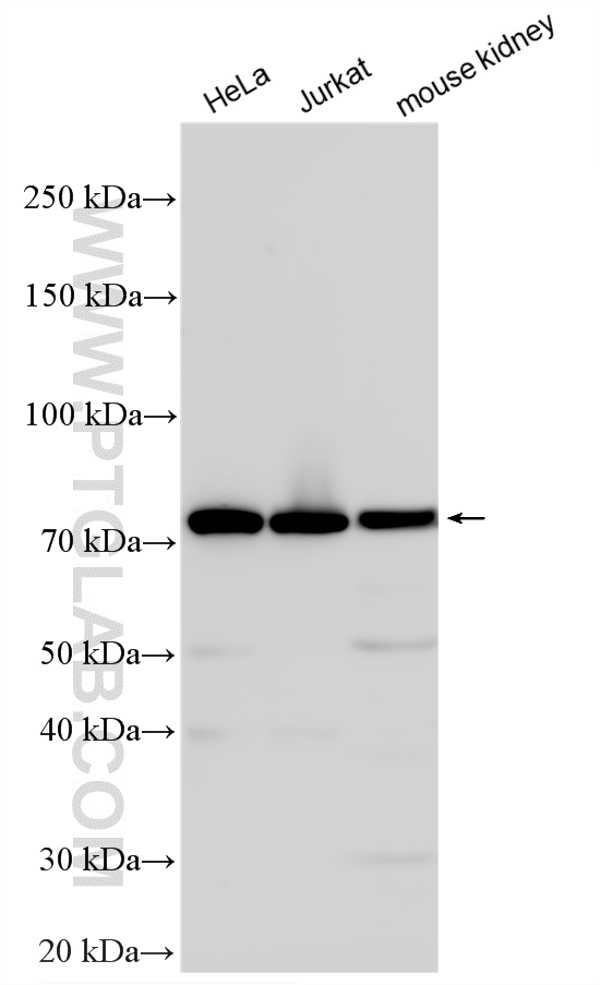 WB analysis using 51046-1-AP