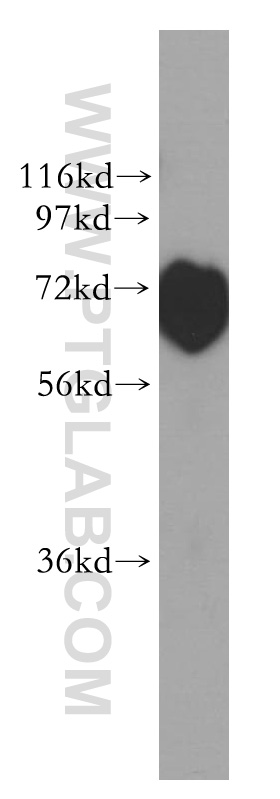 Cd2ap Polyclonal antibody