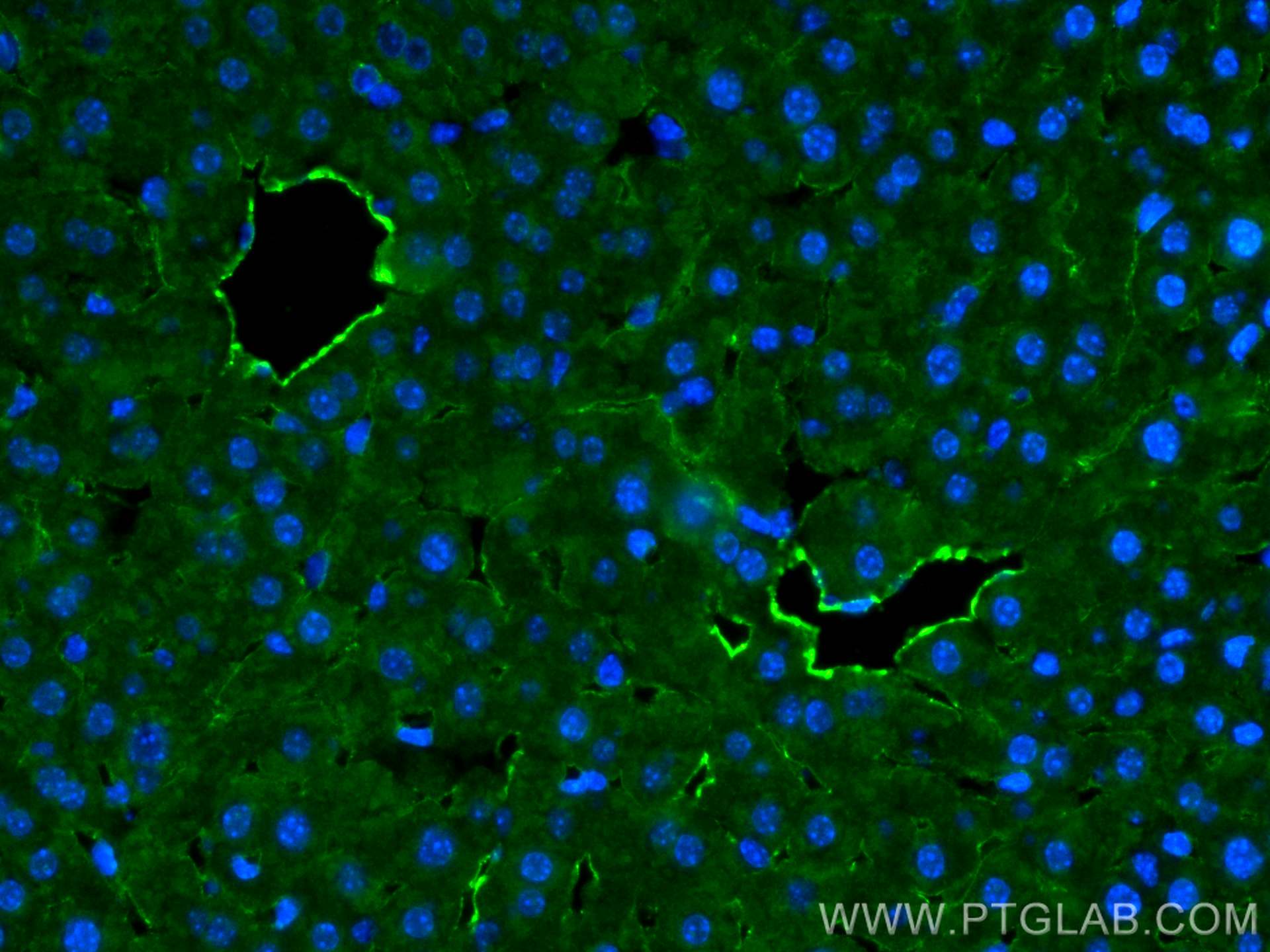 IF Staining of mouse liver using 28083-1-AP