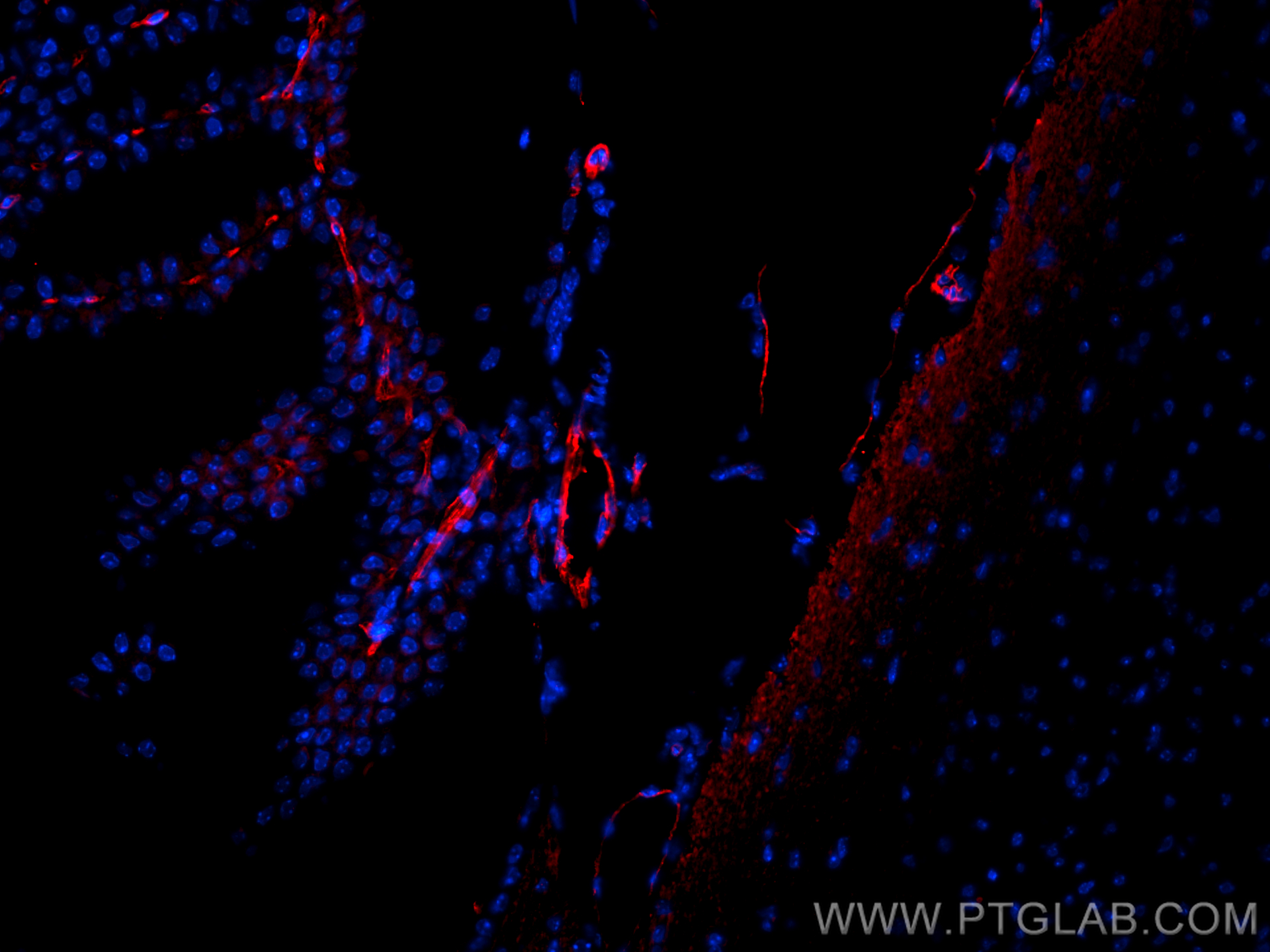 IF Staining of mouse brain using 28083-1-AP