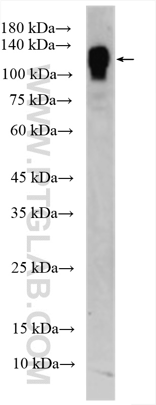 WB analysis of bEnd.3 using 28083-1-AP