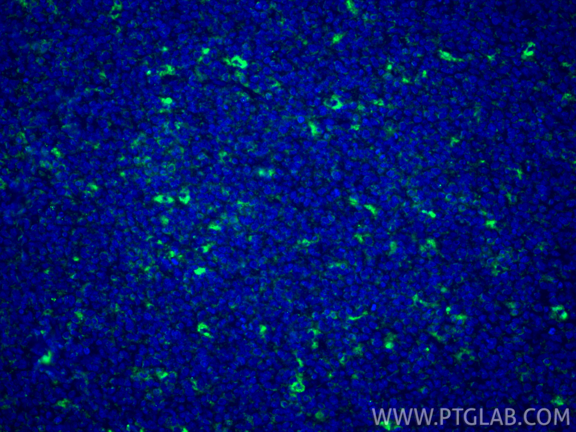 Immunofluorescent analysis of (4% PFA) fixed paraffin-embedded human tonsillitis tissue using CD68 antibody (28058-1-AP) at dilution of 1:200 and CoraLite®488-Conjugated Goat Anti-Rabbit IgG(H+L) (<a class='green' href='/productredirect?CatalogNo=SA00013-2' target='_blank'>SA00013-2</a>). Heat mediated antigen retrieval with Tris-EDTA buffer (pH 9.0). IF Staining of human tonsillitis using 28058-1-AP