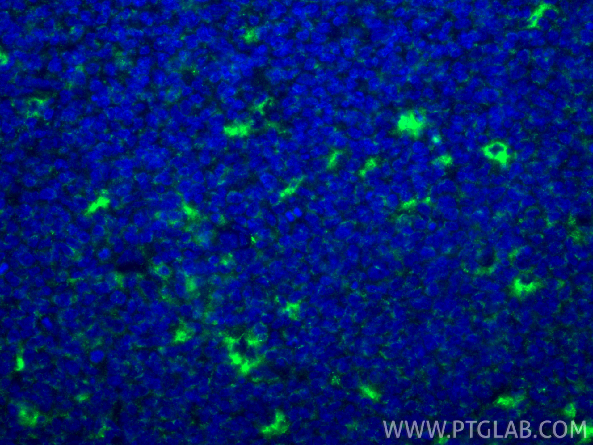 Immunofluorescent analysis of (4% PFA) fixed paraffin-embedded human tonsillitis tissue using CD68 antibody (28058-1-AP) at dilution of 1:200 and CoraLite®488-Conjugated Goat Anti-Rabbit IgG(H+L) (<a class='green' href='/productredirect?CatalogNo=SA00013-2' target='_blank'>SA00013-2</a>). Heat mediated antigen retrieval with Tris-EDTA buffer (pH 9.0). IF Staining of human tonsillitis using 28058-1-AP