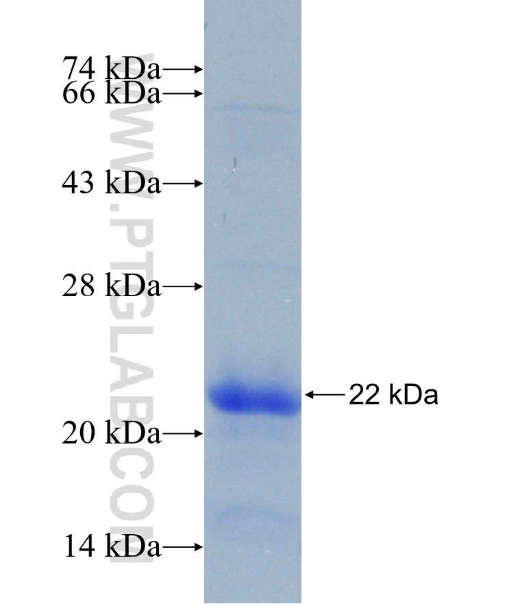 Cdkn1a fusion protein Ag28394 SDS-PAGE