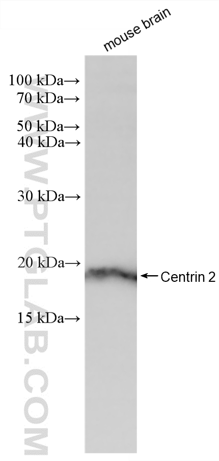 WB analysis of mouse brain using 88406-1-RR (same clone as 88406-1-PBS) WB analysis of mouse brain using 88406-1-RR (same clone as 88406-1-PBS)