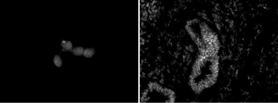 Chd5 antibody (mAb) (Clone 5A10) tested by immunofluorescence. Left: HeLa cells. Right: E12.5 mouse gut. Both stained with Chd5 antibody. Chd5 antibody (mAb) (Clone 5A10) tested by immunofluorescence. Left: HeLa cells. Right: E12.5 mouse gut. Both stained with Chd5 antibody.