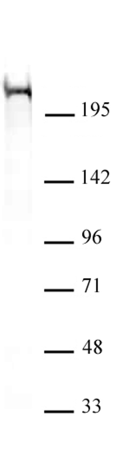 Chd5 antibody (mAb) (Clone 5A10) tested by Western blot. Chd5 antibody detection by Western blot. The analysis was performed using 40 ug of HeLa nuclear extract and Chd5 antibody at a 2 ug/ml dilution. Chd5 antibody (mAb) (Clone 5A10) tested by Western blot. Chd5 antibody detection by Western blot. The analysis was performed using 40 ug of HeLa nuclear extract and Chd5 antibody at a 2 ug/ml dilution.