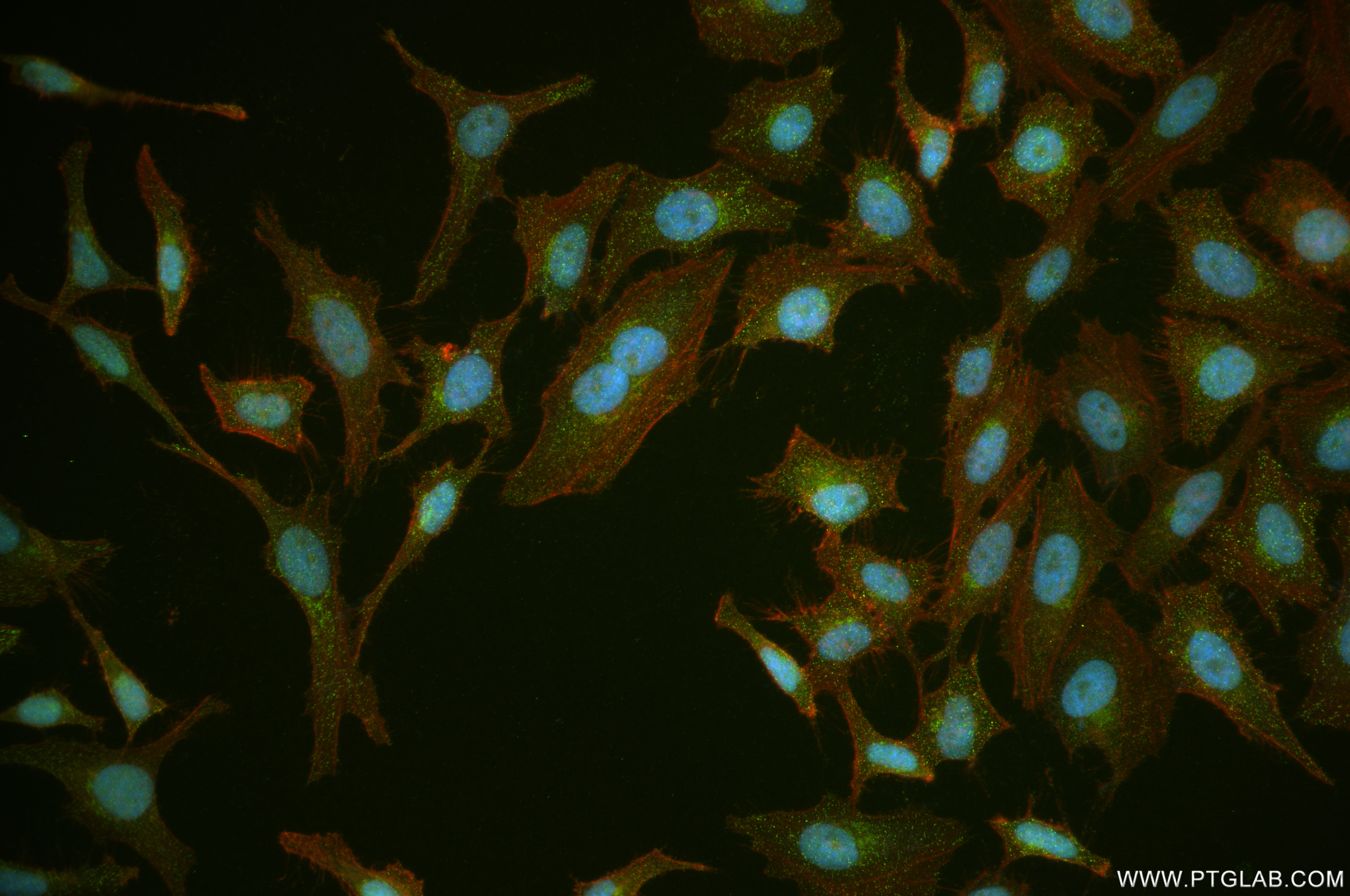 IF Staining of HeLa using 84905-1-RR (same clone as 84905-1-PBS)
