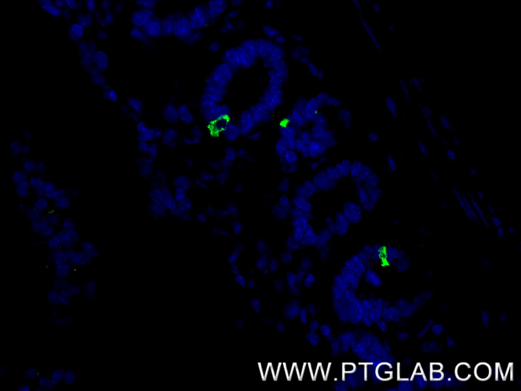 Immunofluorescent analysis of (4% PFA) fixed paraffin-embedded mouse small intestine tissue using Chromogranin A antibody (<a class='green' href='/productredirect?CatalogNo=85605-2-RR' target='_blank'>85605-2-RR</a>, Clone: 243048H7 ) at dilution of 1:200 and CoraLite®488-Conjugated Goat Anti-Rabbit IgG(H+L) (<a class='green' href='/productredirect?CatalogNo=SA00013-2' target='_blank'>SA00013-2</a>). Heat mediated antigen retrieval with Tris-EDTA buffer (pH 9.0). This data was developed using the same antibody clone with 85605-2-PBS in a different storage buffer formulation. IF Staining of mouse small intestine using 85605-2-RR (same clone as 85605-2-PBS)