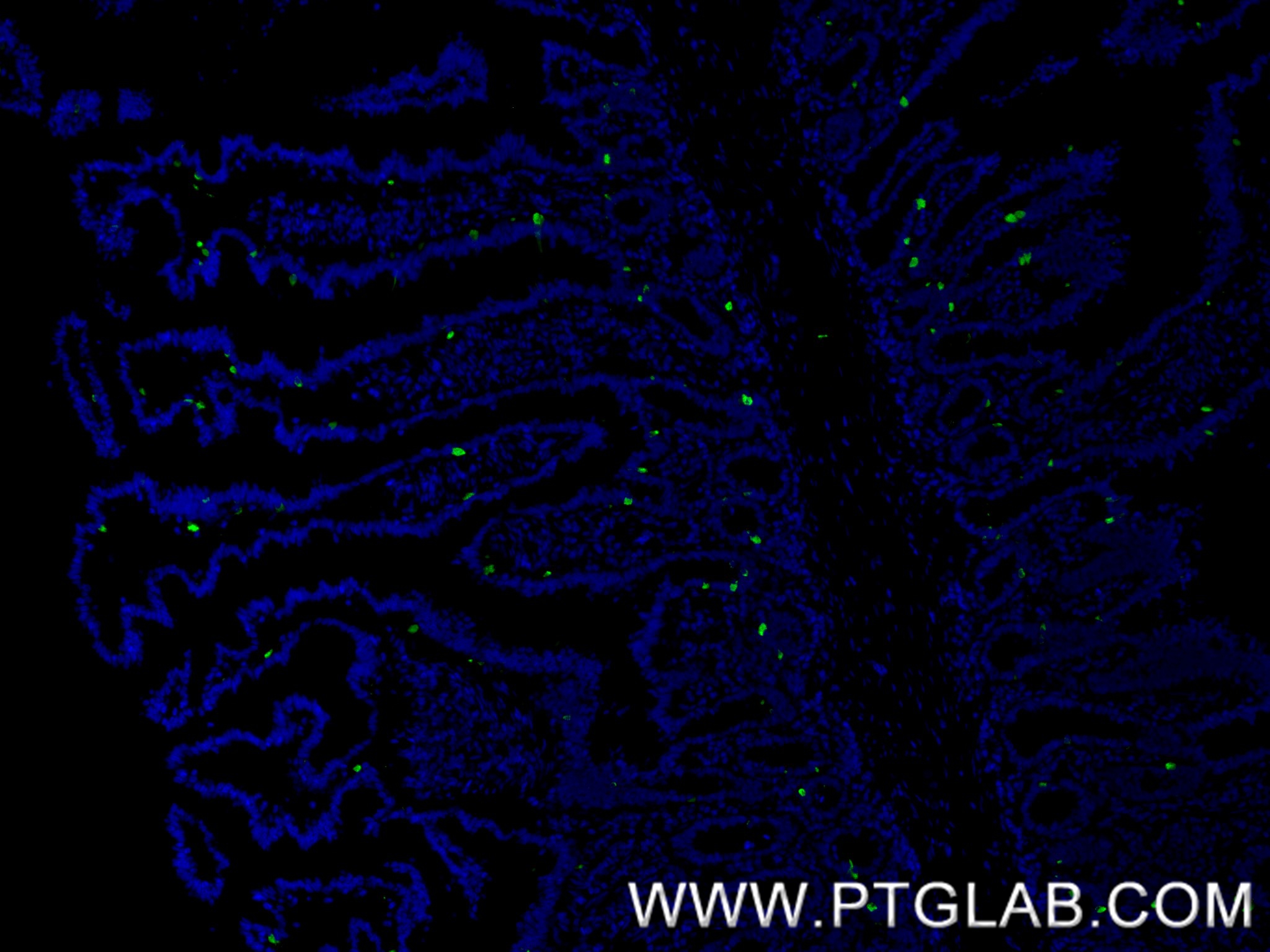 IF Staining of human small intestine using 85605-2-RR IF Staining of human small intestine using 85605-2-RR