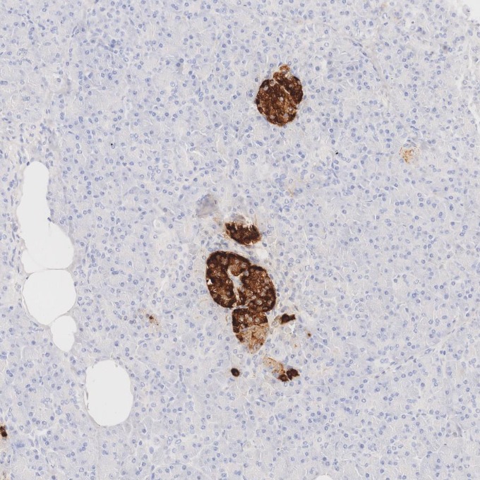 IHC staining of human pancreas using 85605-2-RR IHC staining of human pancreas using 85605-2-RR