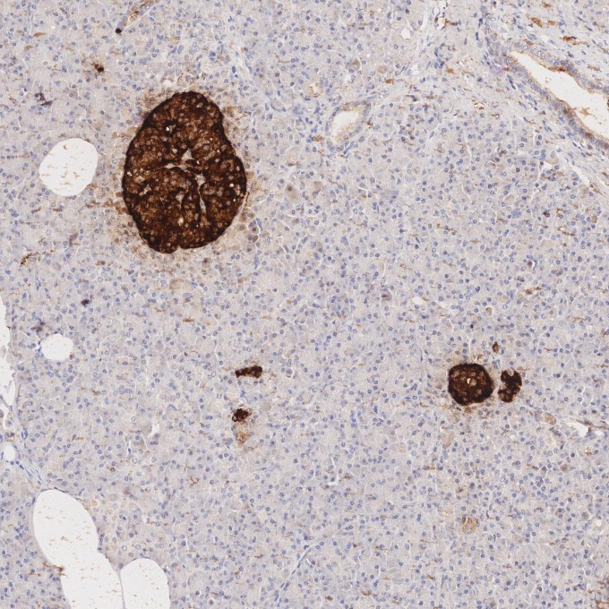 IHC staining of human pancreas using 85605-2-RR IHC staining of human pancreas using 85605-2-RR