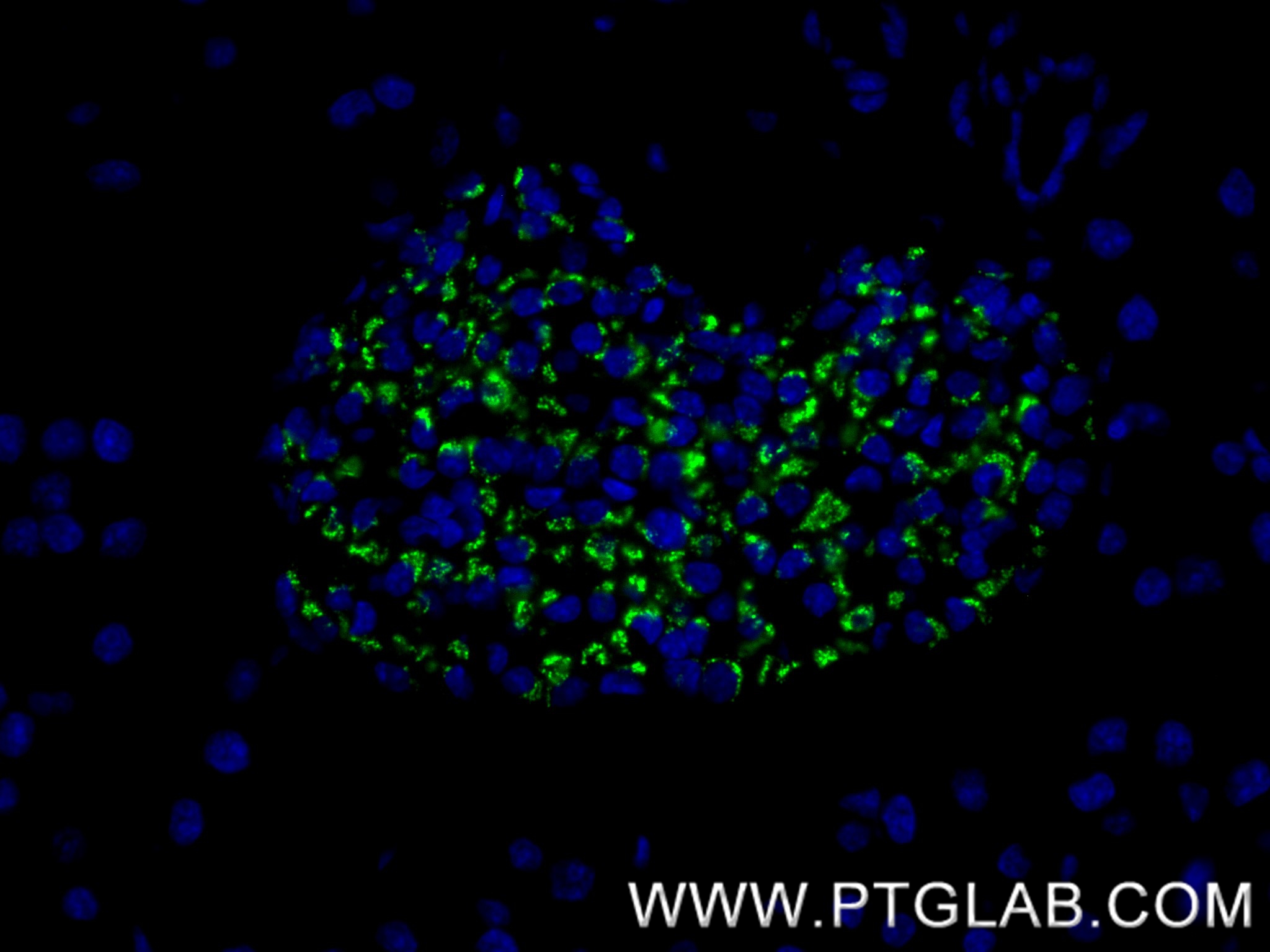 IF Staining of mouse pancreas using 86447-1-RR (same clone as 86447-1-PBS)