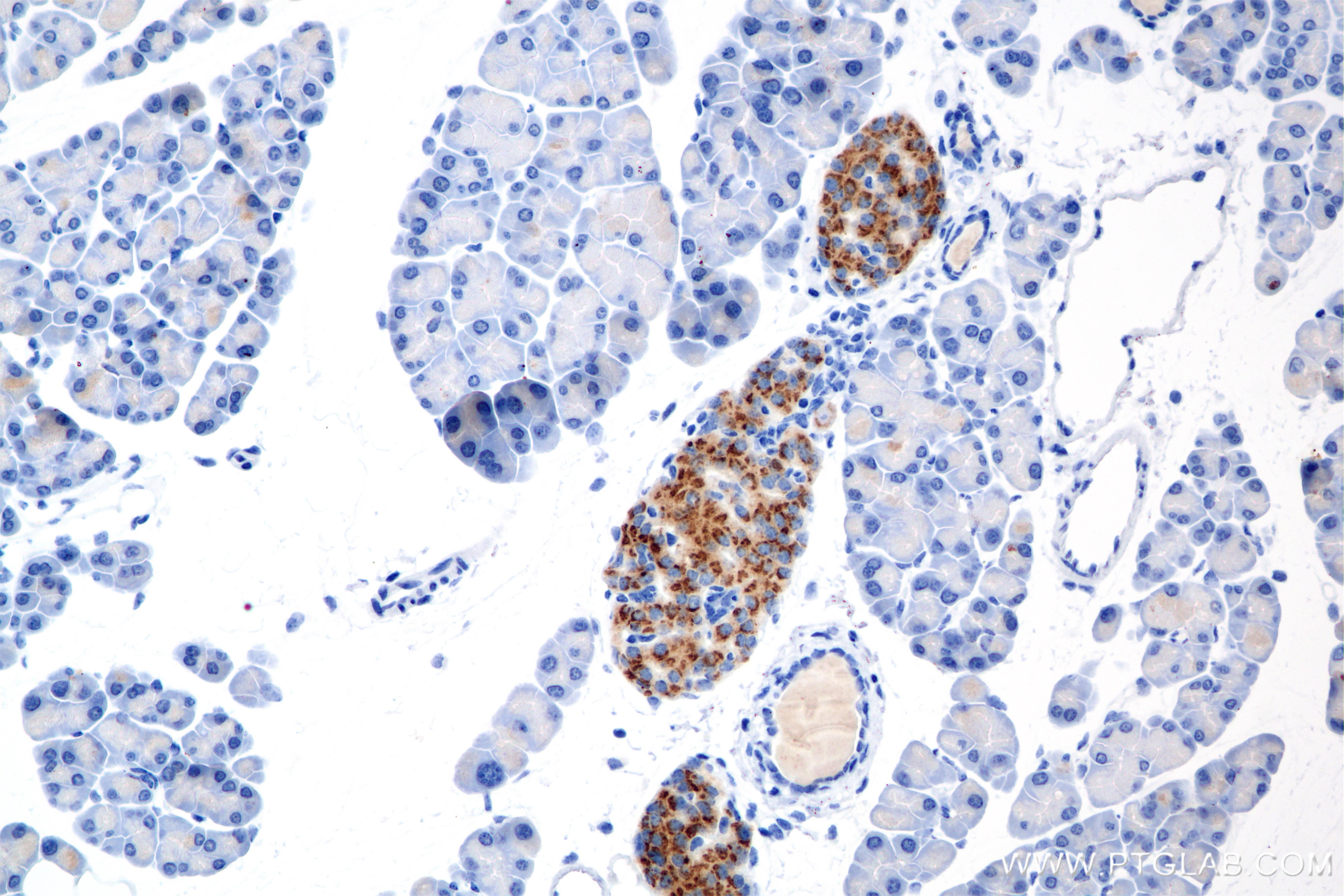 IHC staining of mouse pancreas using 86447-1-RR (same clone as 86447-1-PBS)