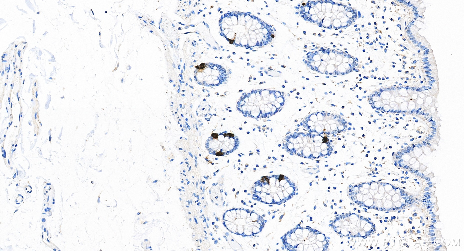 IHC staining of human colon using 98570-1-RR (same clone as 98570-1-PBS)