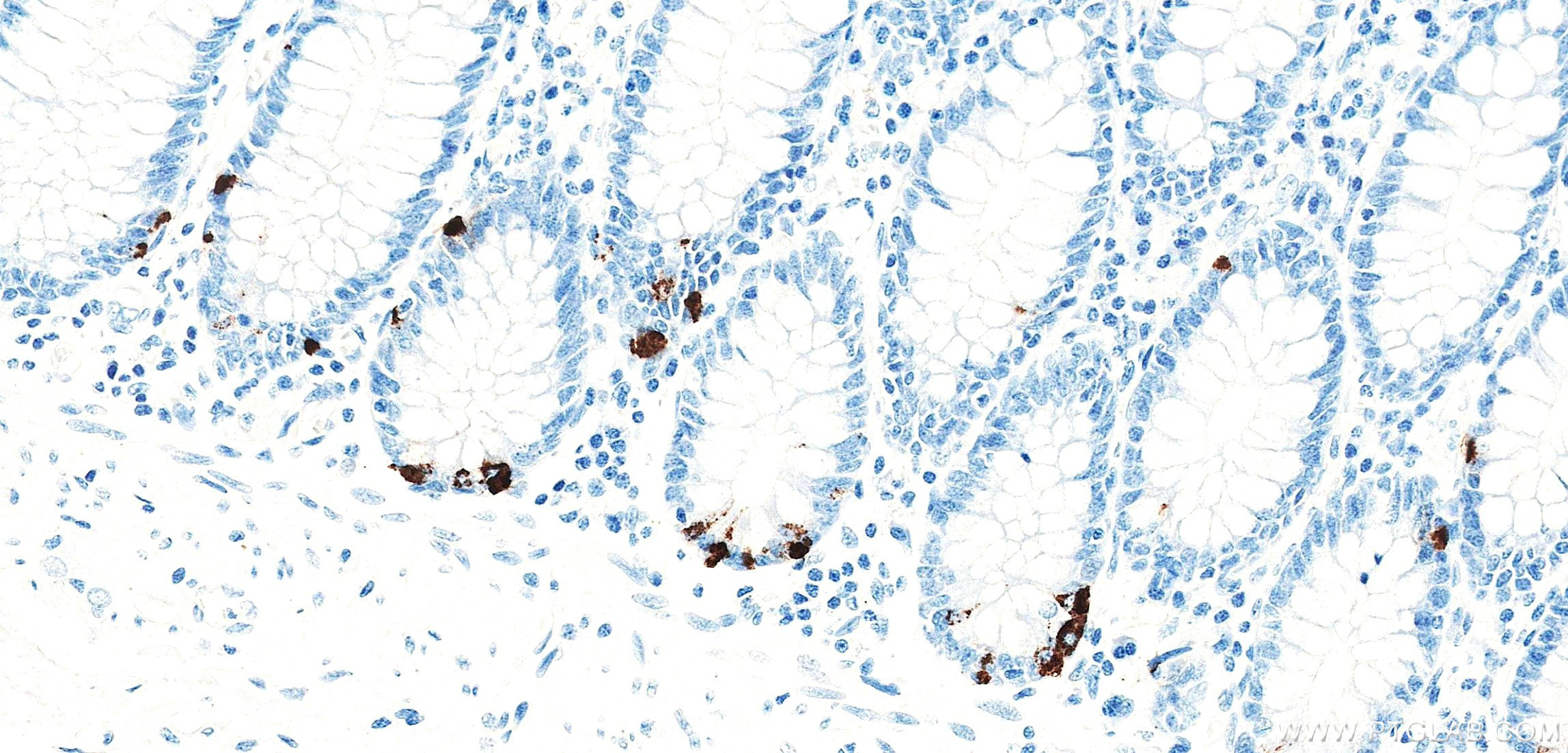 IHC staining of human colon using 98570-1-RR (same clone as 98570-1-PBS)