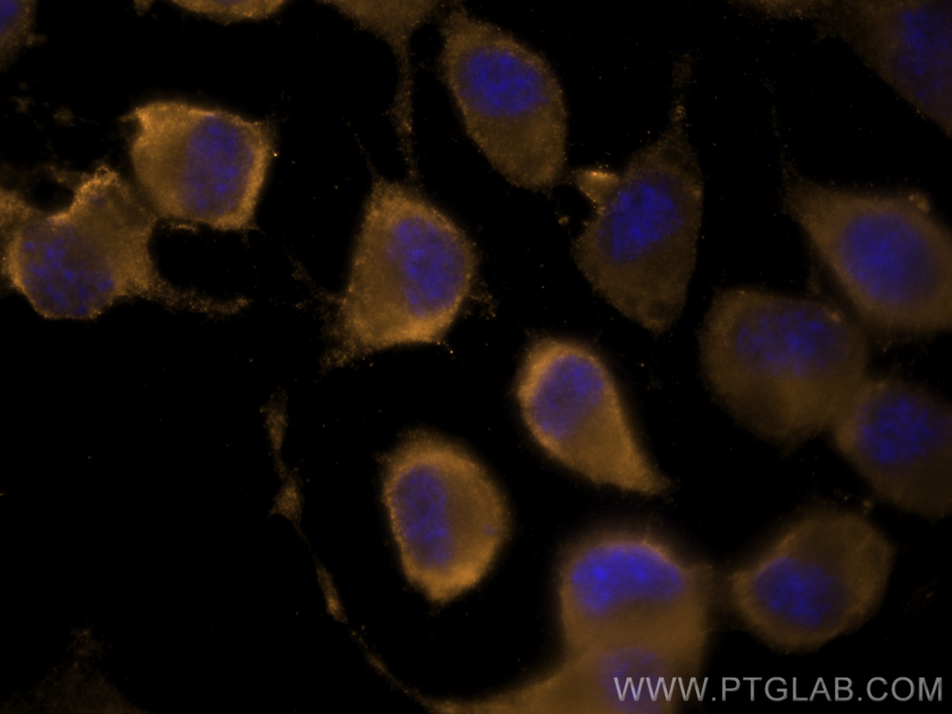 IF Staining of Neuro-2a using CL555-60135