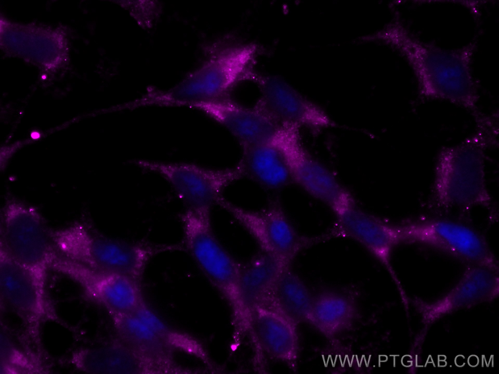 IF Staining of SH-SY5Y using CL647-60135